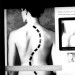 spine