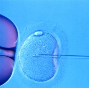 IVF