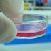Petri Dish - Health News - Israel