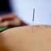 Chinese Medicine - Health News - Israel Chinese Medicine - Health News - Israel