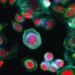 Cancer cells - Health News - Israel Cancer cells - Health News - Israel