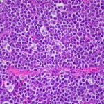 144136195 3024b1cfa7 z 150x150 Study: How To Make Chemotherapy Side Effects Less Deadly