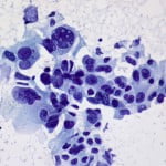Discovery: Protein Increases Lifespan Of Mice By 16 Percent Cancer cell 150x150 Discovery: Protein Increases Lifespan Of Mice By 16 Percent