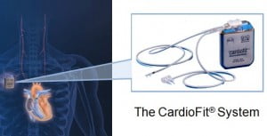 Health News: Israeli Company Uses New Technology To Battle Heart Failure