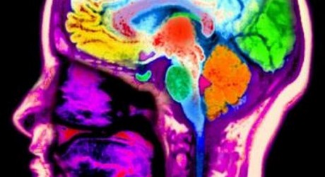 Health News: Israeli Researchers Map Brain Microstructure