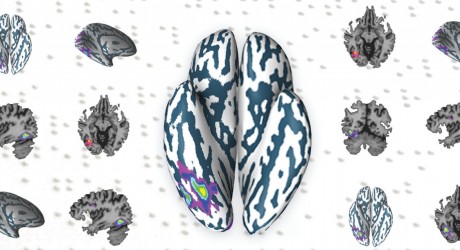 HU Scientists Teach The Blind To "See" Using Sound