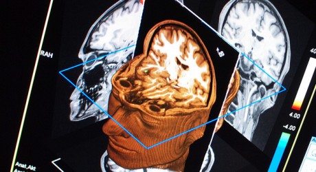 Health News: Israeli Researchers Track Emotional Trauma In The Brain