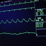 heart monitor 150x150 Research Succeeds In Isolating Cancer Stem Cells