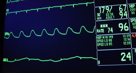 Health News: Israeli Scientists Create "Biological Pacemaker" From Stem Cells