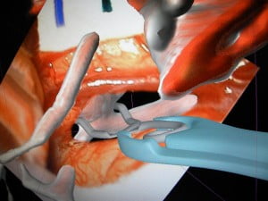 surgical theater 300x225 Flight Simulation Technology Helps Doctors Prepare For Brain Surgery