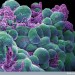 Health News: Researchers Identify Enzyme Which Triggers Cancer