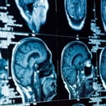 brain repair 580 150x150 Research Finds Fools Gold Regulates World Oxygen Levels