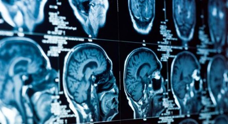 Health News: Research: Oxygen-Rich Air Can Cure Damaged Brain Cells