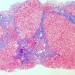 Health News: Israeli Makes Breakthrough Discovery In Liver Disease Treatment