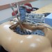 Health News - Mazor: Building The Spinal Surgeon's Million-Dollar Robotic Sidecick