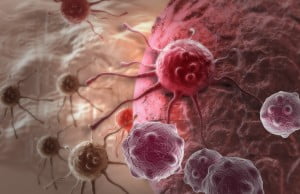 Cancer Cells via Bigstock
