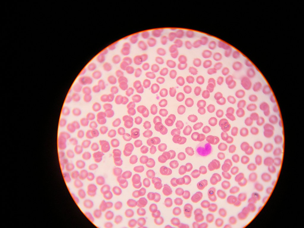 White Blood Cells. Photo by Alkhwarizmi Center for Bioinformatics