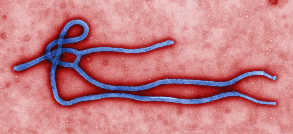 This colorized transmission electron micrograph (TEM) revealed some of the ultrastructural morphology displayed by an Ebola virus virion. See PHIL 1832 for a black and white version of this image.Where is Ebola virus found in nature?The exact origin, locations, and natural habitat (known as the "natural reservoir") of Ebola virus remain unknown. However, on the basis of available evidence and the nature of similar viruses, researchers believe that the virus is zoonotic (animal-borne) and is normally maintained in an animal host that is native to the African continent. A similar host is probably associated with Ebola-Reston which was isolated from infected cynomolgous monkeys that were imported to the United States and Italy from the Philippines. The virus is not known to be native to other continents, such as North America via  NIAID/Flickr