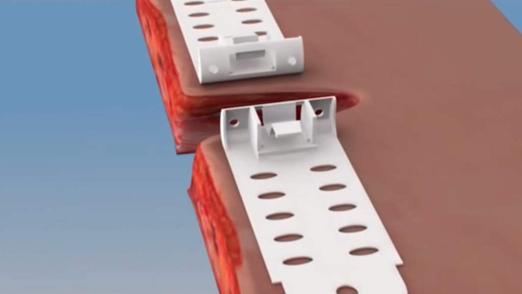 A screenshot from a promotional video demonstrating how TopClosure works.