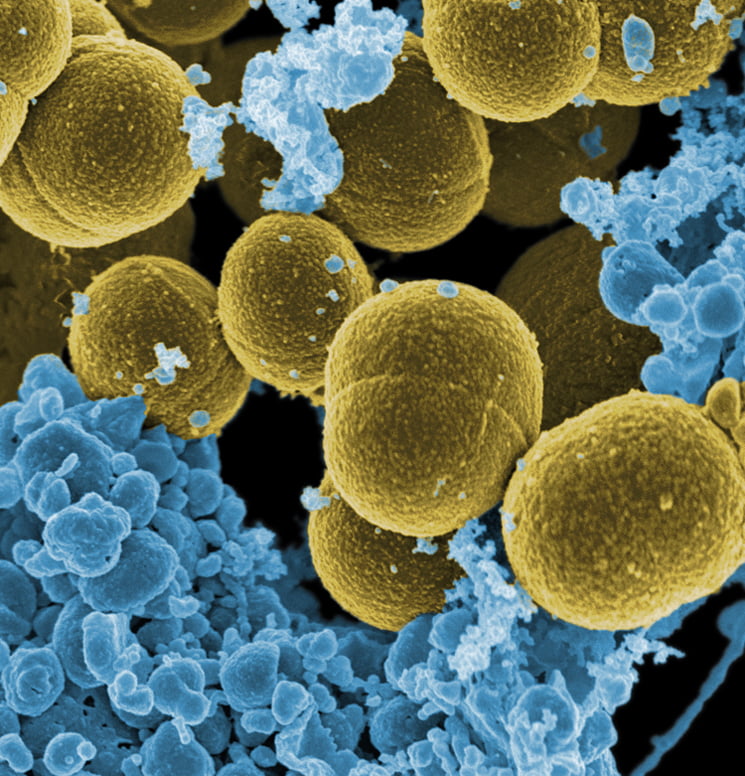 Staphylococcus aureau bacteria