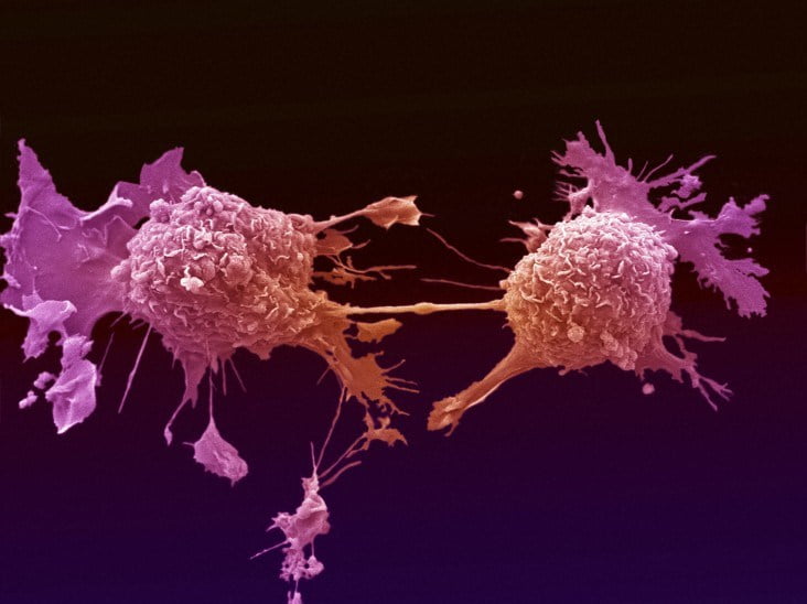 Lung cancer cell dividing via BigStcok