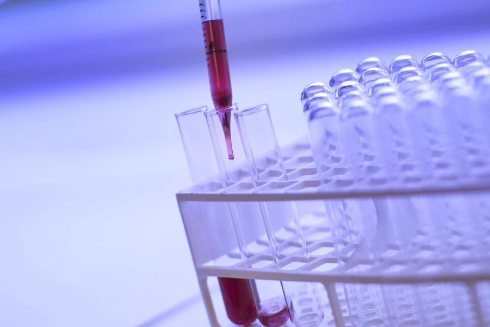 Test Tubes Blood Lab via Pixabay