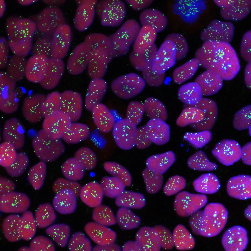 Haploid Human Embryonic Stem Cells. Photo by Azrieli Center for Stem Cells and Genetic Research at Hebrew University