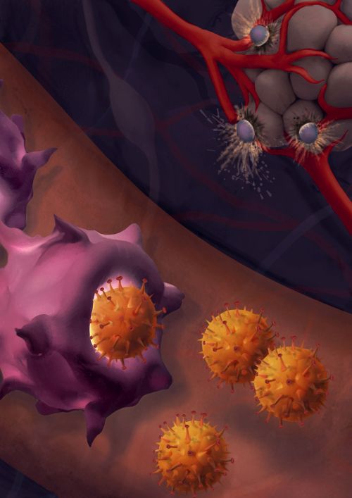 The Nano-vaccine enhances the sensitivity of melanoma to immunotherapy to destroy cancer. Illustration: Maayan Harel
