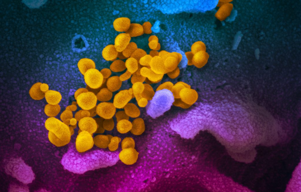 This scanning electron microscope image shows SARS-CoV-2 (yellow) -also known as 2019-nCoV, the virus that causes COVID-19—isolated from a patient in the US, emerging from the surface of cells (blue/pink) cultured in the lab. Image by NIAID Rocky Mountain Laboratories, Wikimedia, Public Domain