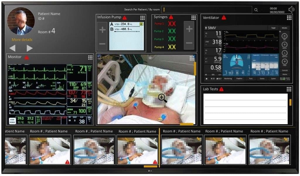 The 'cockpit' is a supervision system that makes it possible to collect data on ventilated COVID-19 patients. It is a system developed in collaboration with IAI, Microsoft, the Soroka Medical Center, and other partners. Photo: IAI 