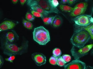 Cancer cells - Health News - Israel via GE Healthcare on Flcikr