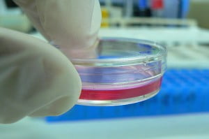 Petri Dish - Health News - Israel