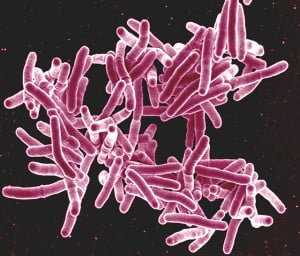 bacteria kit - health news