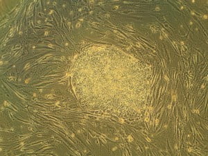 Human stem cell - Health News - Israel