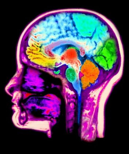 Health News: Israeli Researchers Map Brain Microstructure