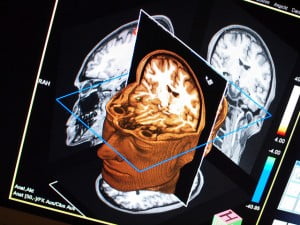 Health News: Israeli Researchers Track Emotional Trauma In The Brain