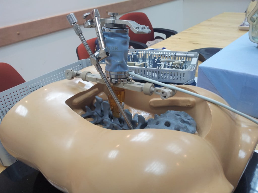 Health News - Mazor: Building The Spinal Surgeon's Million-Dollar Robotic Sidecick