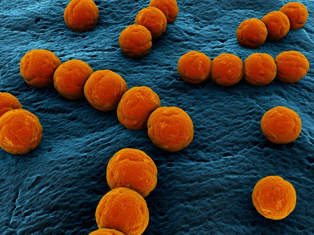 Health News: Researchers Identify What Turns Harmless Bacteria To Flesh-Eating Killer