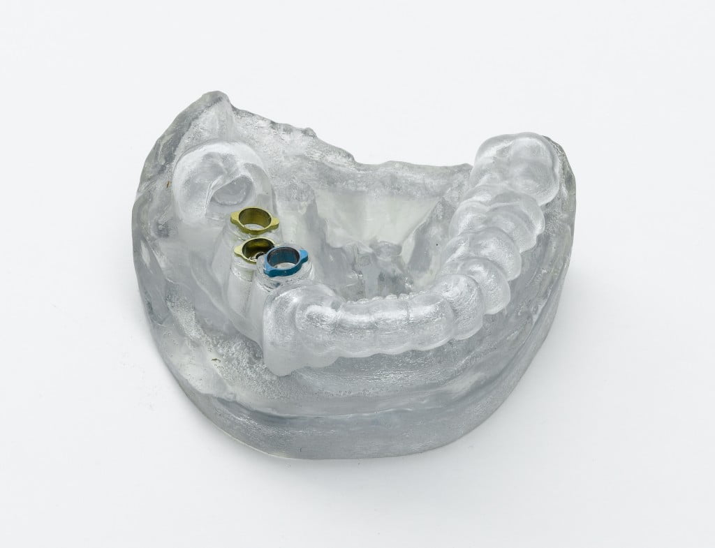 Health News: 3D Printing Tech Can Solve A Lot Of Problems For Orthodontists
