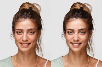Facetune app demo before and after