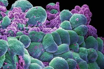 Cancer Cells via BigStock