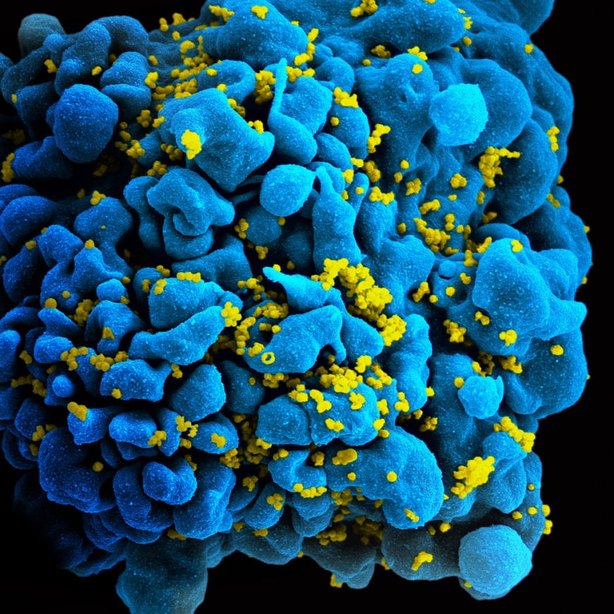 HIV Infected Cell via NIAID/Flickr