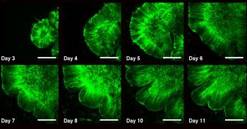 Prof. Orly Reiner of the Weizmann Institute’s Molecular Genetics Department grew organoidsin the lab. Courtesy