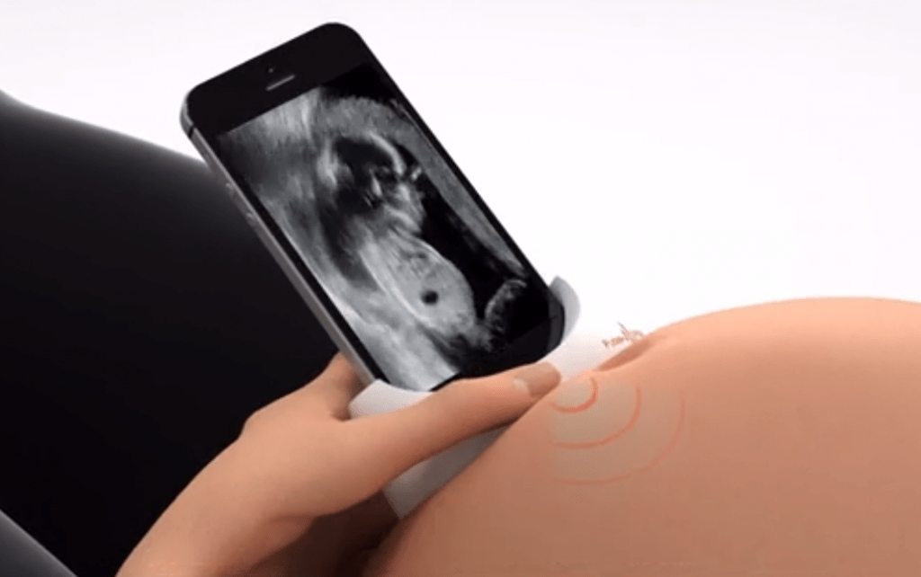 Computerized footage of an ultrasound device in development by Israeli startup PulseNmore that would let an expectant mother check on her baby through her smartphone. (Screen capture: Hadashot)