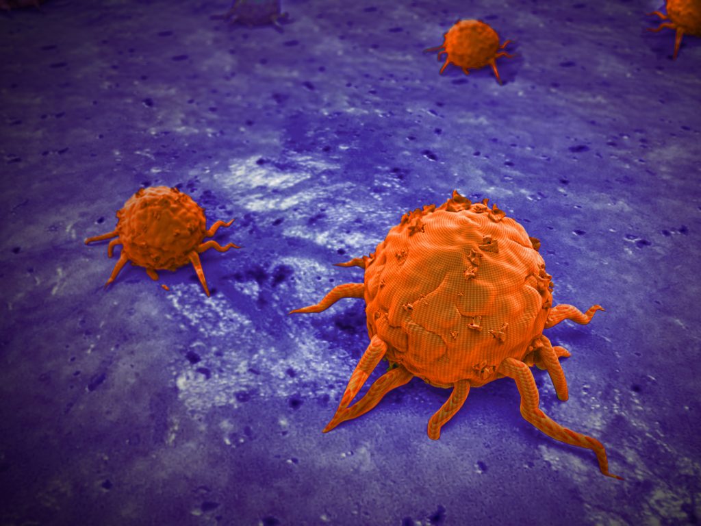 3D illustration of cancer cells. Deposit Photos