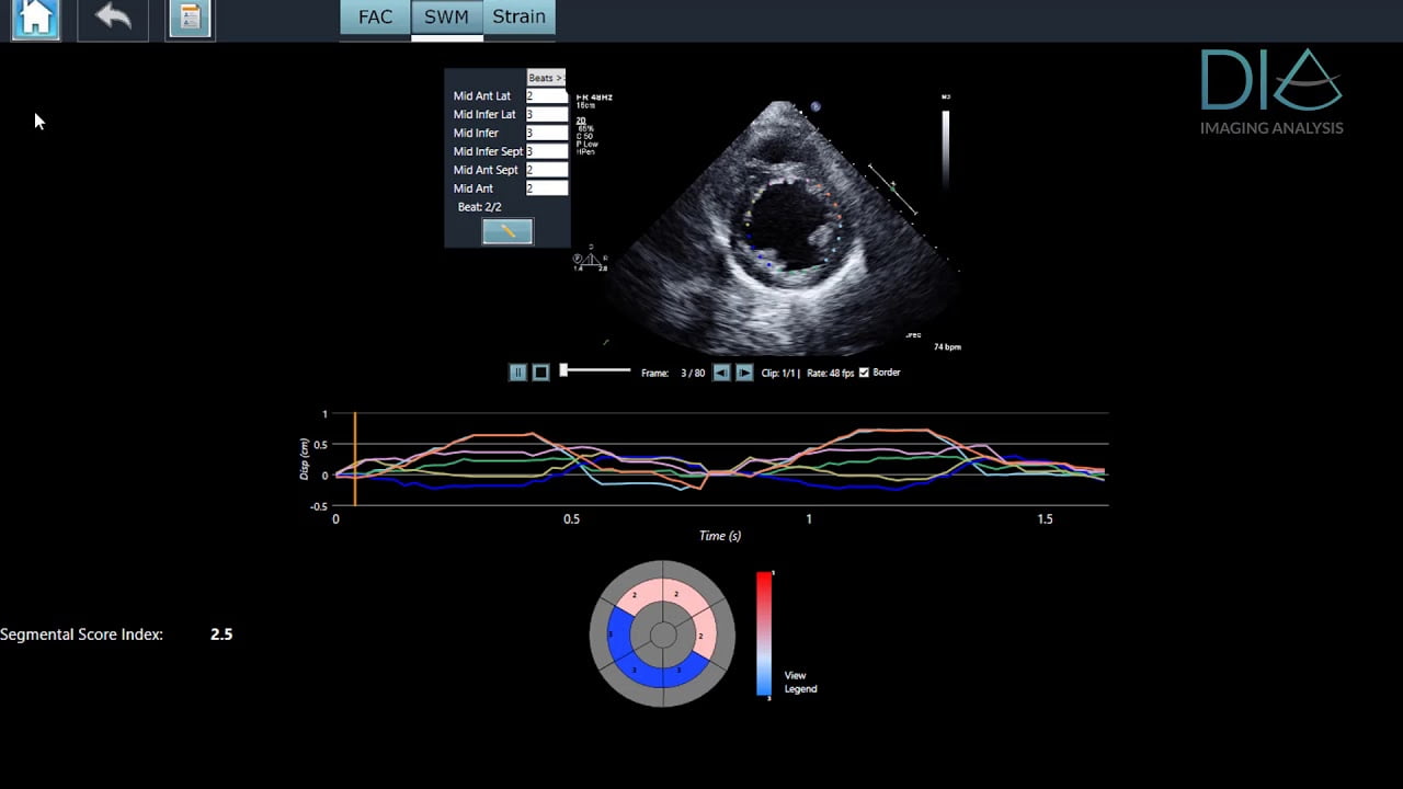 Israeli AI Medical Imaging Startup DiA Partners With IBM Watson Health