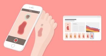 Healthy.io launches wound care management solution via smartphone. Image via Healthy.io's website,