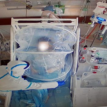 Tamar's COVID-19 ventilation system is deployed in Jerusalem coronavirus ward. Courtesy
