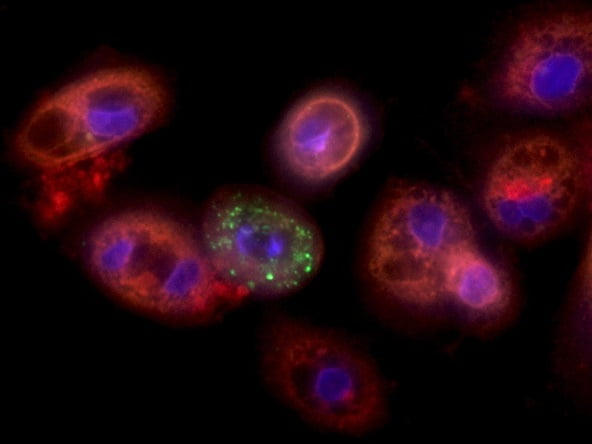 An image showing lung cells infected with coronavirus, provided by Professor Yaakov Nahmias.