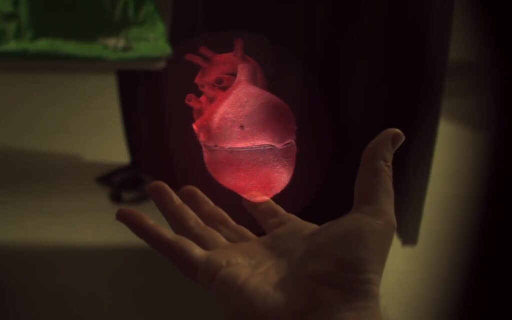 RealView creates digital 3D holograms in the physician's hand. Photo: Screenshot via RealView Imaging